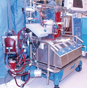 I think this is a picture of one of those machines that pumps the blood when your heart isn't doing it.)(Photo Credit: FirstHeartNorth.com)