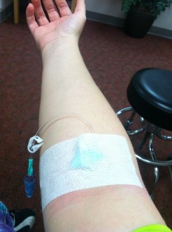 Aurora's arm with an IV inserted