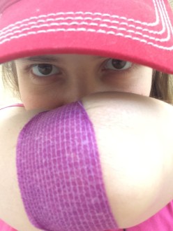Aurora De Lucia looking out from behind her bandaged arm after a blood test in the UCLA kidney donor program